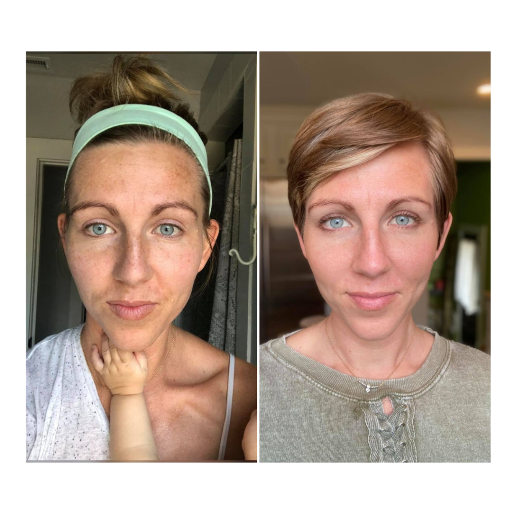 vitamin c skincare results